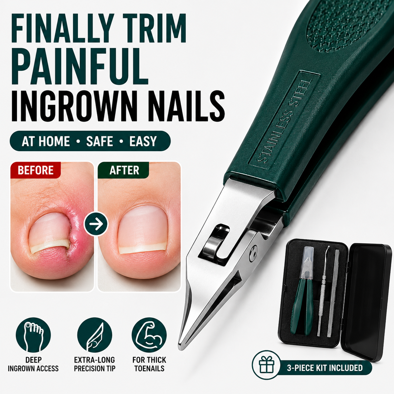 Eagle Beak Beveled Nail Clippers | Premium 3-Piece Grooming Kit ✂️🛡️